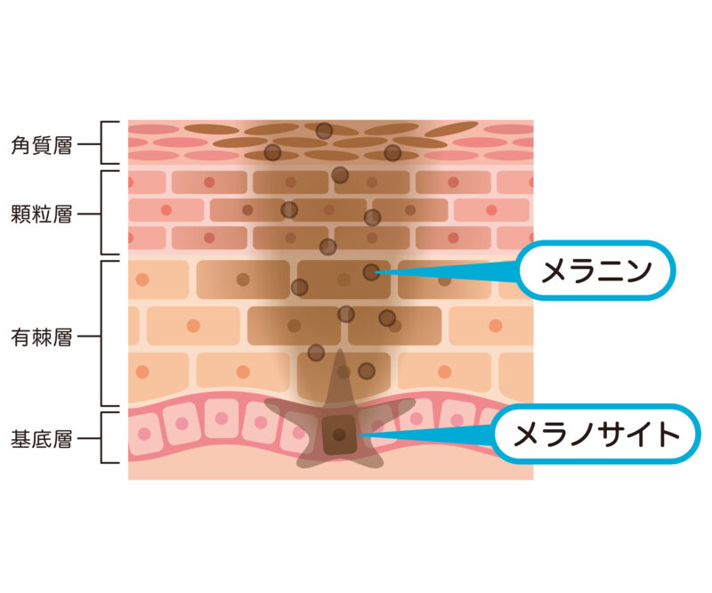 茶クマの原因