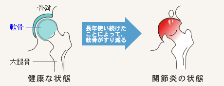 大人のおしゃれ手帖 股関節