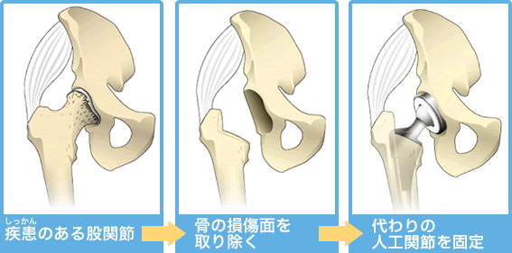 大人のおしゃれ手帖 股関節